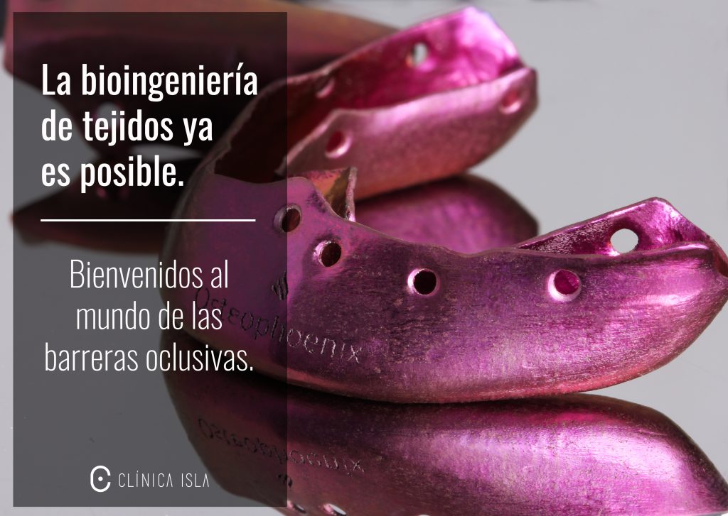 barreras oclusivas
